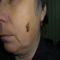 3. Шкірний ріг 