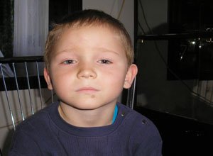 1. Шкірний ріг