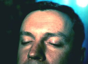 2. Шкірний ріг