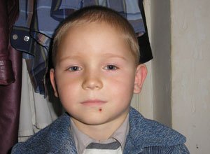 1. Шкірний ріг