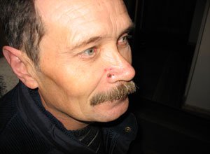 6. Папілома на носі