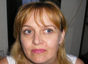 8. Множинні дерматофіброми