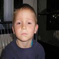 1. Шкірний ріг